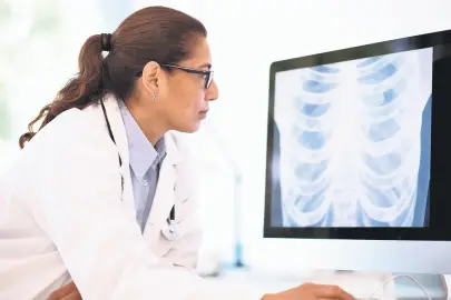 Akciğer kanseri kadınlarda artıyor